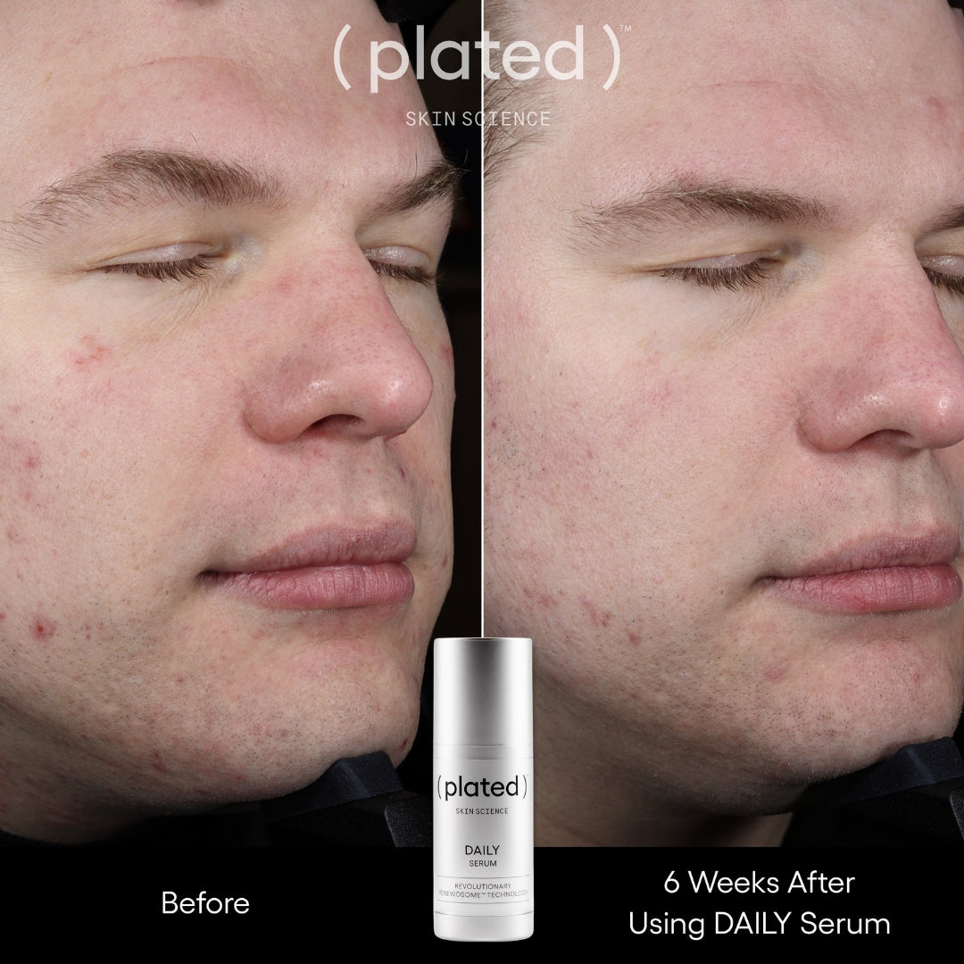 Plated Science Daily Serum