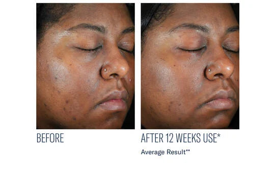 SkinBetter Science Even Intensive Skin Correcting Serum 50ml