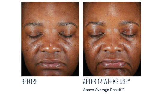 SkinBetter Science Even Intensive Skin Correcting Serum 50ml
