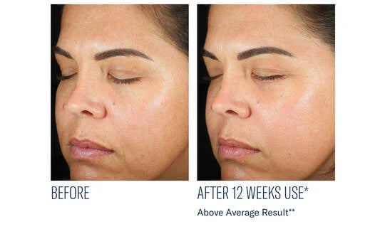 SkinBetter Science Even Intensive Skin Correcting Serum 50ml